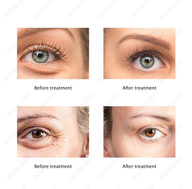 moonlight-06 moonlight-06